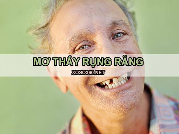 Mơ rụng răng đánh con gì trúng lớn? Điềm dữ hay lành?