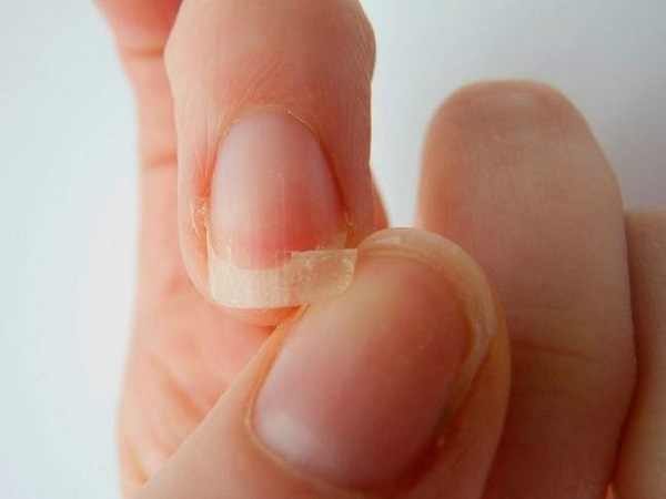 Nằm mơ thấy gãy móng tay là điềm gì, tốt hay xấu?
