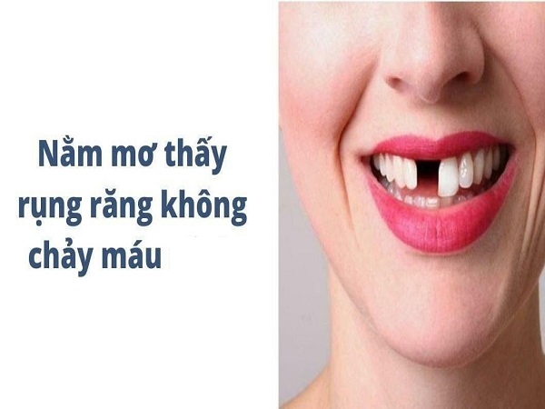 Mơ thấy răng cửa bị gãy không chảy máu