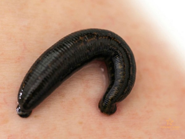 Nằm mơ thấy đỉa cắn có số gì phát lộc có điềm gì